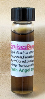 BRUISES/BURNS Soothing Skin-Healing Blend #2